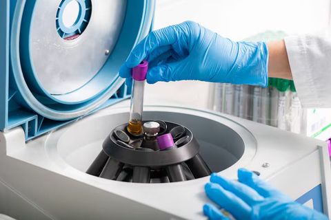 Chemical Centrifuges Overview: Technologies Driving Process Optimization